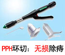 PPH微创术.jpg