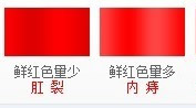 便血是怎么回事,便血的原因