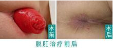 28-15112109593CN.jpg